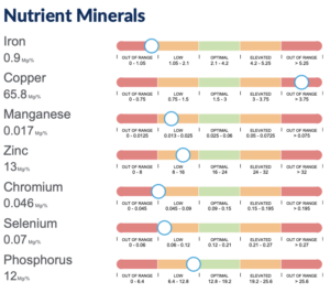 dawn plotts Nutrient Minerals HTMA test of 13 year old client